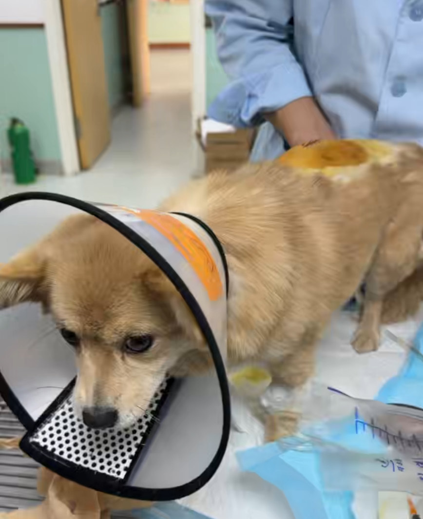汉堡术后第一次检查