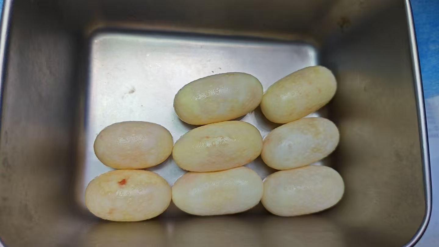 从玉米蛇体内取出的8枚滞留卵